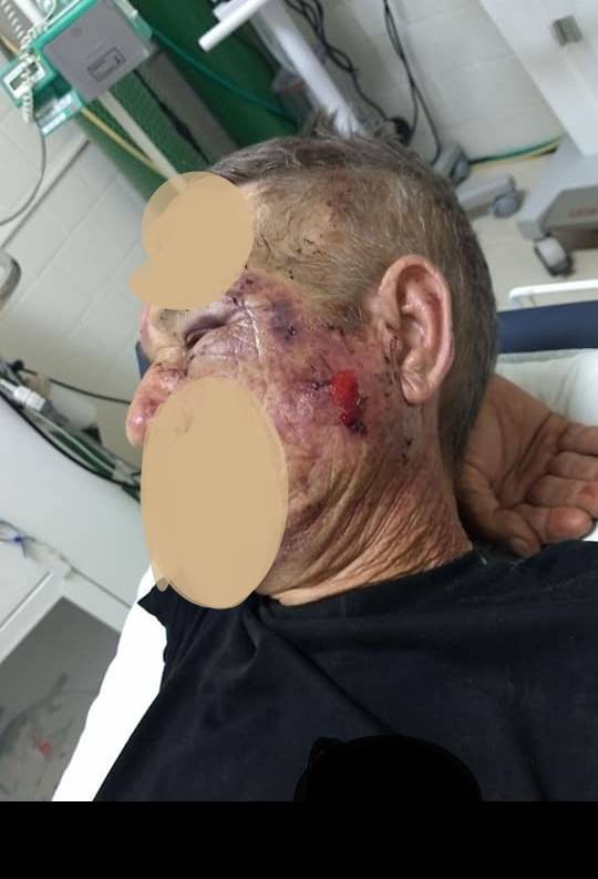 Homem é assaltado e agredido quando retornava do trabalho durante a madrugada em Horizontina